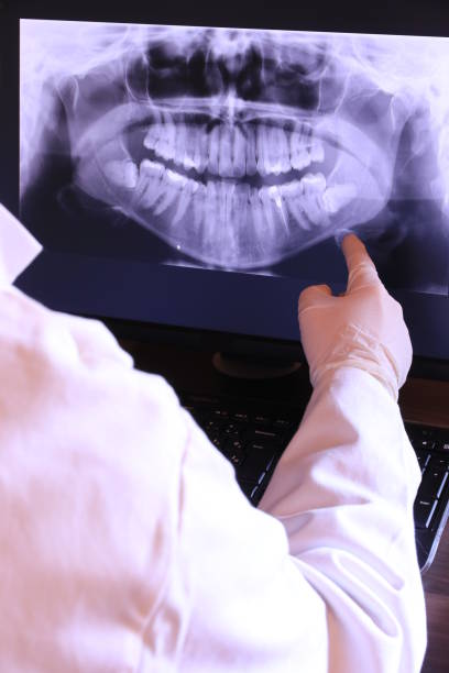 Best Dental Abscess Treatment in Homer, MI