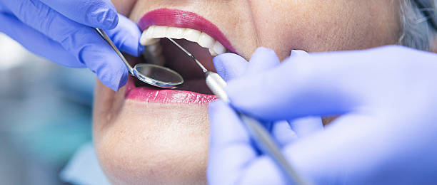 Best Emergency Wisdom Tooth Extraction in Homer, MI
